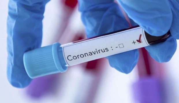 Corona virüsü için ilk ilacı hangi ülke bulur?
